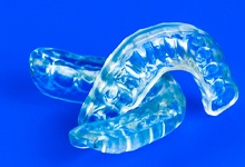 Custom mouthguards from an implant dentist in San Antonio