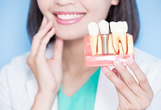 dentist displaying a dental implant model 