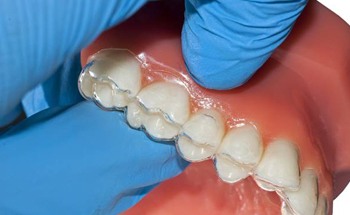 clear aligner on dental mold