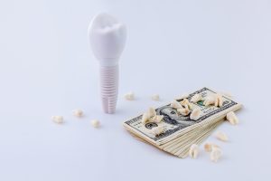 dental implant and money