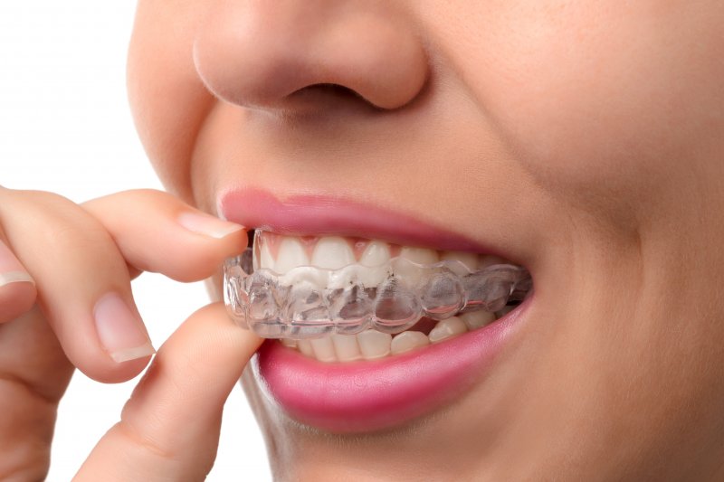 a woman with a set of Invisalign aligners