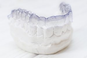 Dental model showing Invisalign in San Antonio. 